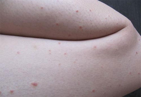 ���ϳ������ʲôԭ�� ���𳤺��Ŀ�������